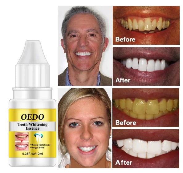 OEDO Teeth Whitening Essence Powder Oral Hygiene Cleaning Serum Removes Plaque Stains Tooth Bleaching Dental Tools Toothpaste