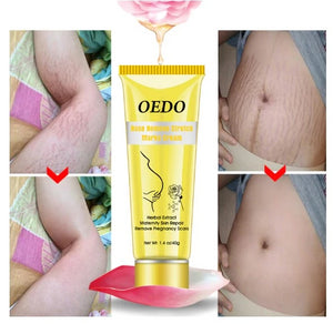 Rose Remove Stretch Marks Cream Anti Wrinkle Anti Aging Maternity Skin Repair Remove Pregnancy Scars Treatment Body Skin Care