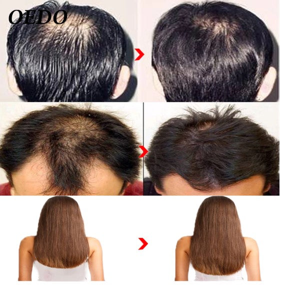 Morocco Herbal Ginseng Hair Care Essence Treatment For Men And Women Hair Loss Fast Powerful Hair Growth Serum Repair Hair root