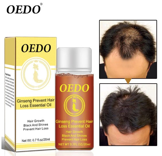 20ML Ginseng Hair Growth Essence Preventing Hair Loss Liquid Damage Hair Repair Treatment Dense Fast Restoration Hair Growth