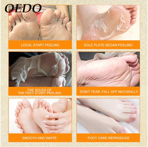 Hot! 1Packs Feet Exfoliating Foot Mask Magic Skin Peeling Dead Skin Feet Mask Socks Sosu Socks For Pedicure Socks Foot Mask Foot