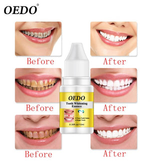 OEDO Teeth Whitening Essence Powder Oral Hygiene Cleaning Serum Removes Plaque Stains Tooth Bleaching Dental Tools Toothpaste